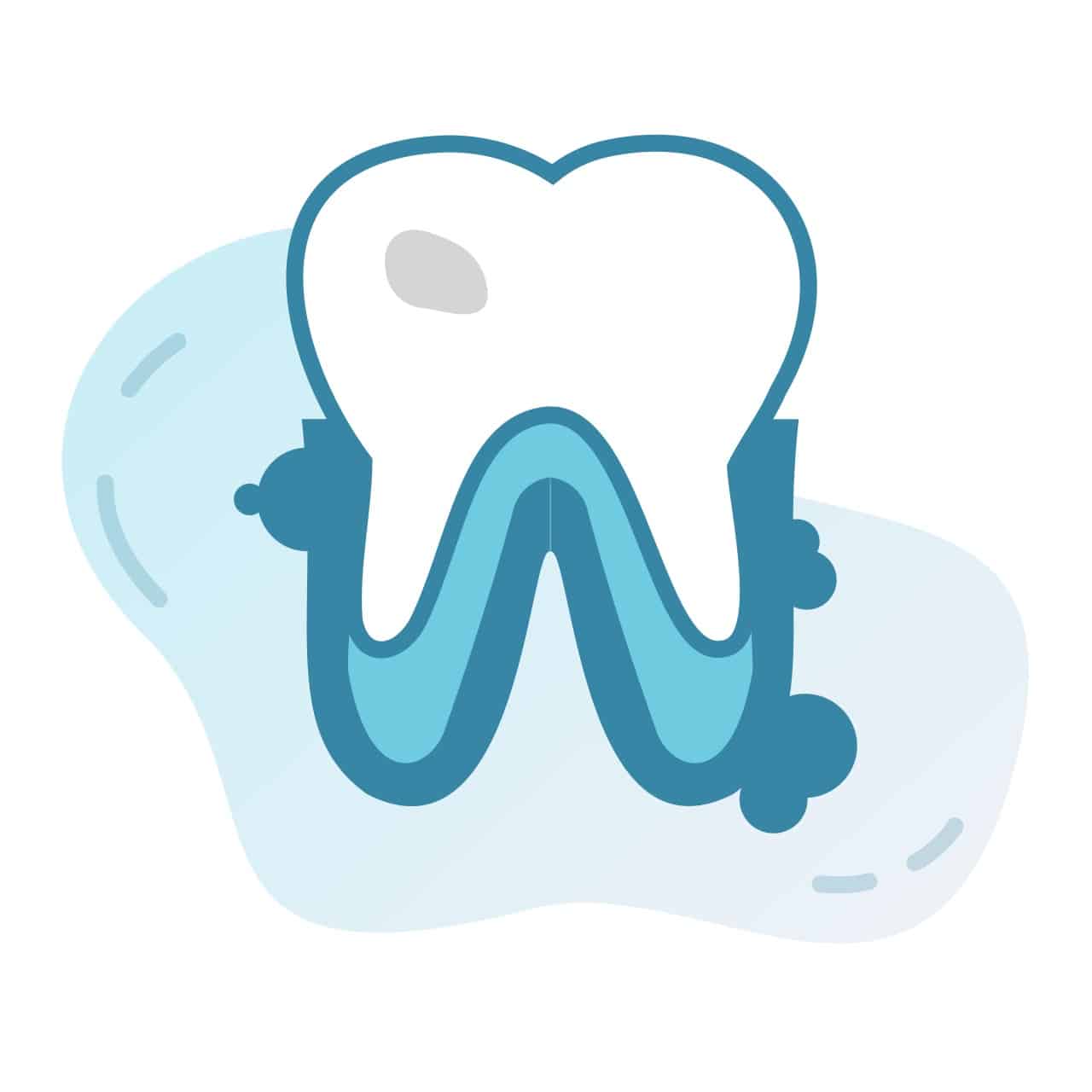 dental-care-arlington-heights-dental-services-gum-disease