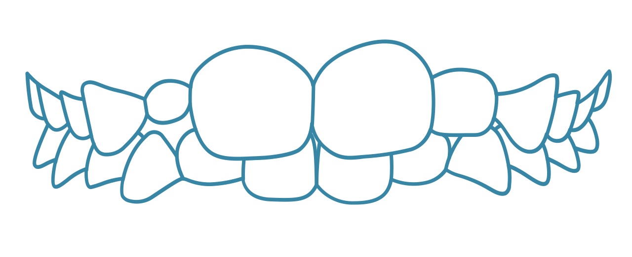 invisalign-mixed-baby-teeth-permanent-teeth-dental-care-arlington-heights