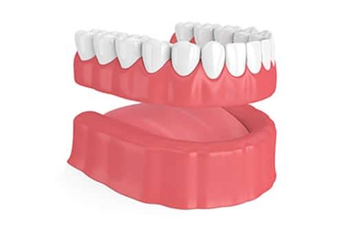 cosmetic-dentistry-dentures-dental-care-mount-prospect-08