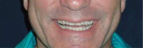 dentist-near-me-before-cosmetic-dentistry-dental-care